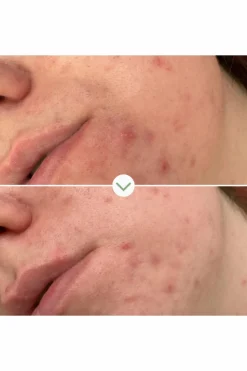 Gel nettoyant purifiant Phaze