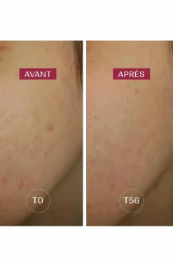 Sérum anti-taches