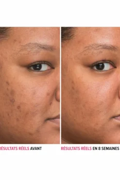 Sérum anti-taches à la niacinamide Bye Bye Serum