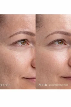 Sérum anti-taches Kojic alternative